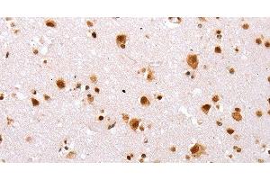 Immunohistochemistry of paraffin-embedded Human brain tissue using TBX2 Polyclonal Antibody at dilution 1:32 (TBX2 antibody)