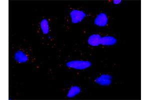 Proximity Ligation Analysis of protein-protein interactions between LCK and DLG1. (DLG1 antibody  (AA 1-90))