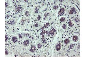 Immunohistochemical staining of paraffin-embedded Human breast tissue using anti-SCFD1 mouse monoclonal antibody. (SCFD1 antibody)