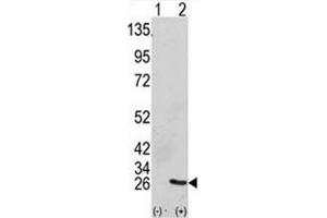 Western blot analysis of GRB2 antibody and 293 cell lysate (2 ug/lane) either nontransfected (Lane 1) or transiently transfected with the GRB2 gene (2). (GRB2 antibody  (AA 89-118))