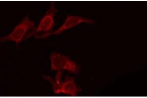 ABIN6266616 staining 293 by IF/ICC. (Patched 1 antibody  (N-Term))