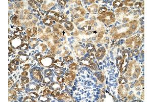 C3orf31 antibody was used for immunohistochemistry at a concentration of 4-8 ug/ml to stain Epithelial cells of renal tubule (arrows) in Human Kidney.