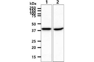 The cell lysate (40ug) were resolved by SDS-PAGE, transferred to PVDF membrane and probed with anti-human ACADS antibody (1:1000). (ACADS antibody  (AA 25-412))