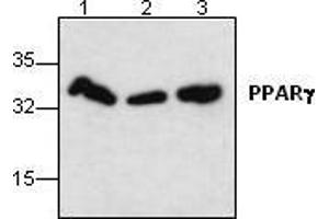 Image no. 1 for anti-Peroxisome Proliferator-Activated Receptor gamma (PPARG) antibody (ABIN191899) (PPARG antibody)
