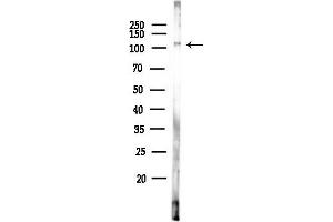 anti-High Mobility Group 20B (HMG20B) (N-Term) antibody
