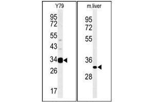 Western blot analysis: AIG1 Antibody staining of Mouse liver tissue lysates (Right) and Y79 cell line lysates (Left) (35 ug/lane). (AIG1 antibody  (N-Term))