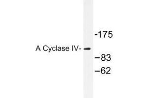 Image no. 1 for anti-Adenylate Cyclase 4 (ADCY4) antibody (ABIN317941) (ADCY4 antibody)