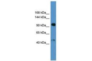 Image no. 1 for anti-Apolipoprotein A (APOA) (AA 3653-3702) antibody (ABIN6746794) (LPA antibody  (AA 3653-3702))