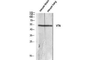Western Blot (WB) analysis of Mouse Brain Mouse Lung lysis using VTN antibody. (Vitronectin antibody)
