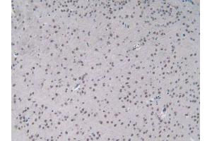 IHC-P analysis of Mouse Brain Tissue, with DAB staining. (IL-2 antibody  (AA 10-169))