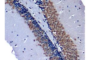 Immunohistochemistry (IHC) image for anti-Nucleophosmin (Nucleolar phosphoprotein B23, Numatrin) (NPM1) (AA 20-154) antibody (ABIN1175784)