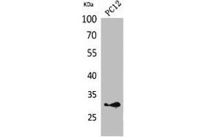 Western Blot analysis of PC12 cells using HLA-DQB1/2 Polyclonal Antibody. (HLA-DQB2 antibody  (Internal Region))