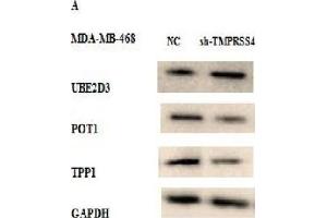 Western Blot Analysis was Performed to Study the Effect of TMPRSS4 Expression Modulation on Telomere Integrity in Stably Transfected MDA-MB-468 and MCF-7 Cell Lines by Analyzing the Expression of Certain Proteins Related to Telomere Maintenance (UBE2D3, POT1, and TPP1). (TPP1 antibody  (AA 284-563))