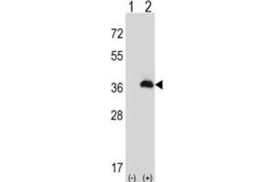 Western Blotting (WB) image for anti-Peroxisomal Biogenesis Factor 16 (PEX16) antibody (ABIN3004053)