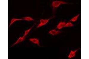 ABIN6274939 staining NIH-3T3 by IF/ICC. (CAPN12 antibody  (Internal Region))