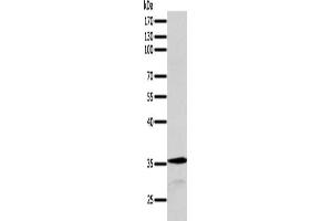 Gel: 10 % SDS-PAGE, Lysate: 40 μg, Lane: MCF7 cells, Primary antibody: ABIN7131278(SYT9 Antibody) at dilution 1/200, Secondary antibody: Goat anti rabbit IgG at 1/8000 dilution, Exposure time: 1 minute (SYT9 antibody)