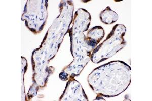 IHC analysis of AEBP2 using anti-AEBP2 antibody (ABIN4886435). (AEBP2 antibody  (AA 424-517))