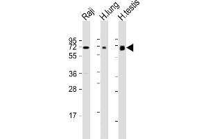 All lanes : Anti-ERVK-7 Antibody (N-Term) at 1:1000-1:2000 dilution Lane 1: Raji whole cell lysate Lane 2: human lung lysate Lane 3: human testis lysate Lysates/proteins at 20 μg per lane. (ERVK-7 antibody  (AA 96-128))