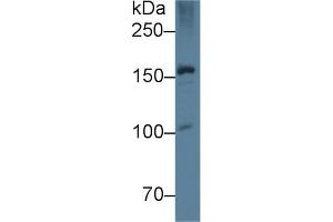 Western Blot; Sample: Rat Liver lysate; Primary Ab: 5µg/ml Mouse Anti-Rat APOB Antibody Second Ab: 0. (APOB antibody  (AA 2747-2913))
