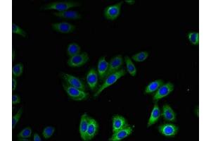 Immunofluorescent analysis of HepG2 cells using ABIN7170251 at dilution of 1:100 and Alexa Fluor 488-congugated AffiniPure Goat Anti-Rabbit IgG(H+L) (SLC41A2 antibody  (AA 1-162))