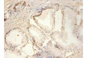 Immunohistochemistry of paraffin-embedded human prostate tissue using ABIN7163321 at dilution of 1:100 (PLA2G2A antibody  (AA 21-144))
