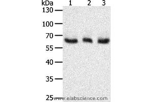 Western blot analysis of A375, Hela and Jurkat cell, using TYR Polyclonal Antibody at dilution of 1:400 (TYR antibody)