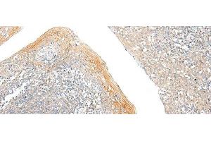 Immunohistochemistry of paraffin-embedded Human tonsil tissue using FAM110D Polyclonal Antibody at dilution of 1:60(x200) (GRRP1 antibody)