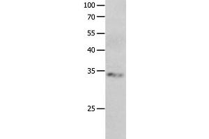 Western Blot analysis of Jurkat cell using RBFOX3 Polyclonal Antibody at dilution of 1:550 (NeuN antibody)