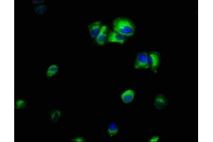 Immunofluorescence staining of MCF-7 cells with ABIN7156505 at 1:66, counter-stained with DAPI. (ILK antibody  (AA 1-228))