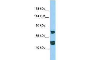 Western Blotting (WB) image for anti-Coiled-Coil Domain Containing 39 (CCDC39) (N-Term) antibody (ABIN2790737) (CCDC39 antibody  (N-Term))