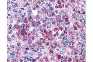 Anti-SGK3 antibody IHC of human spleen. (SGK3 antibody  (AA 107-156))