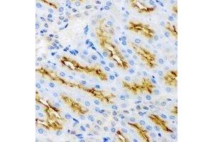 Immunohistochemistry (IHC) image for anti-Protein Kinase, AMP-Activated, beta 2 Non-Catalytic Subunit (PRKAB2) antibody (ABIN7308228) (PRKAB2 antibody)
