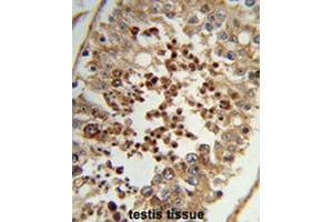 Formalin-fixed and paraffin-embedded human testis tissue reacted with TAC2N Antibody (N-term), which was peroxidase-conjugated to the secondary antibody, followed by DAB staining.