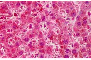 Human Liver: Formalin-Fixed, Paraffin-Embedded (FFPE) (RNF2 antibody  (AA 189-201))