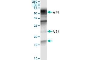 Immunoprecipitation of PTS transfected lysate using anti-PTS MaxPab rabbit polyclonal antibody and Protein A Magnetic Bead , and immunoblotted with PTS MaxPab rabbit polyclonal antibody (D01) . (PTS antibody  (AA 1-145))