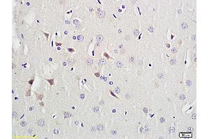 Formalin-fixed and paraffin embedded rat brain labeled with Anti-Activin A, Unconjugated (ABIN734273) followed by conjugation to the secondary antibody and DAB staining (ACVA antibody  (AA 331-426))