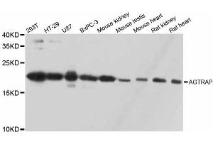 Western blot analysis of extracts of various cell lines, using AGTRAP antibody. (AGTRAP antibody)