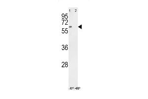 Western blot analysis of anti-hRYK- Pab (ABIN392051 and ABIN2841819) pre-incubated without(lane 1) and with(lane 2) blocking peptide in 293 cell line lysate. (RYK antibody  (C-Term))