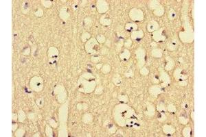 Immunohistochemistry of paraffin-embedded human brain tissue using ABIN7149360 at dilution of 1:100 (CKAP2L antibody  (AA 246-413))