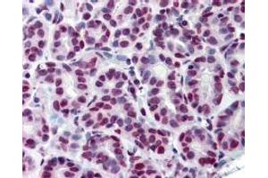 Immunohistochemistry (IHC) image for anti-Signal Transducer and Activator of Transcription 5A (STAT5A) (Tyr694) antibody (ABIN400812) (STAT5A antibody  (Tyr694))