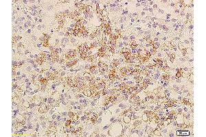 Formalin-fixed and paraffin embedded mouse transplant lymphoma labeled with Anti-Bcl-xL/BCL2L1/bcl-xs, Unconjugated (ABIN675129) at 1:800, followed by conjugation to the secondary antibody and DAB staining. (BCL2L1 antibody  (AA 81-200))