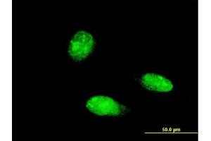 Immunofluorescence of monoclonal antibody to TRIM46 on HeLa cell. (TRIM46 antibody  (AA 451-560))