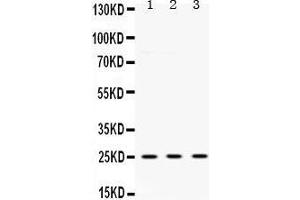 Western Blotting (WB) image for anti-Ubiquitin Carboxyl-terminal Esterase L1 (Ubiquitin Thiolesterase) (UCHL1) (AA 120-153), (C-Term) antibody (ABIN3042339) (UCHL1 antibody  (C-Term))