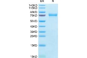 BCAM Protein (AA 26-541) (His tag)