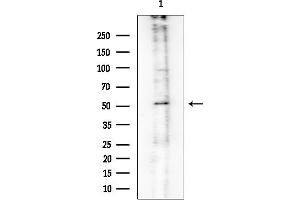 Western blot analysis of lysates from Mouse spleen, using Desmin Mouse Monoclonal Antibody at 1/1000 dilution.