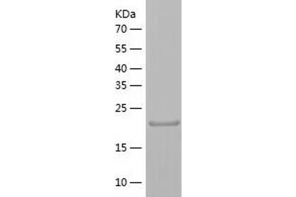 CHMP3 Protein (AA 1-222) (His tag)