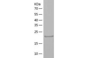 Western Blotting (WB) image for Charged Multivesicular Body Protein 3 (CHMP3) (AA 1-222) protein (His tag) (ABIN7122254) (CHMP3 Protein (AA 1-222) (His tag))