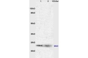 Lane 1: mouse liver lysates Lane 2: myeloma cell sp-20 lysates probed with Anti RAB7 Polyclonal Antibody, Unconjugated (ABIN720191) at 1:200 in 4 °C. (RAB7A antibody  (AA 101-207))