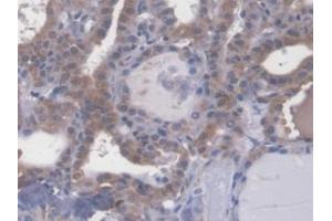 #VALUE! (Esophageal Cancer Related Gene 4 (AA 32-148) antibody)