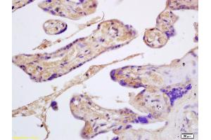 Formalin-fixed and paraffin embedded human placenta labeled with Rabbit Anti GYPB/CD235b/Glycophorin B Polyclonal Antibody, Unconjugated (ABIN1385135) at 1:200 followed by conjugation to the secondary antibody and DAB staining (CD235b/GYPB antibody  (AA 21-91))